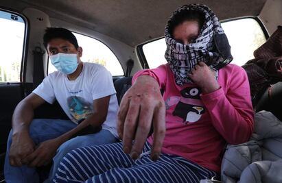 Jacinta advirtió del olor a gas, jefe la ignoró y negocio explotó en Toluca; familia pide ayuda 