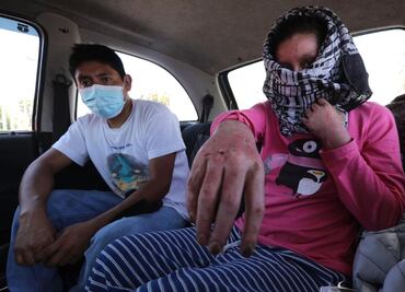 Jacinta advirtió del olor a gas, jefe la ignoró y negocio explotó en Toluca; familia pide ayuda