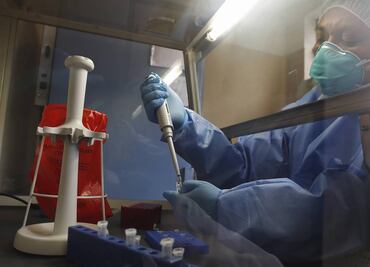 Coronavirus pone en peligro los logros en la lucha contra la tuberculosis: OMS