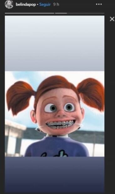 Belinda luce su sonrisa con brackets