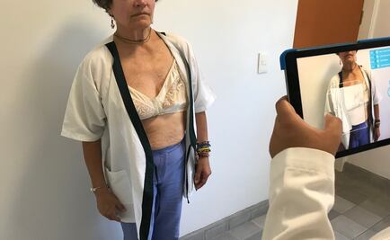 Estudiantes mexicanos elaboran prótesis mamarias en 3D