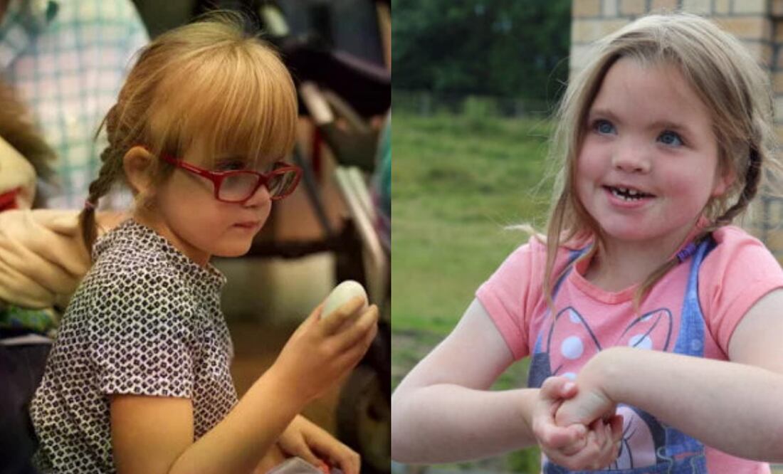 Como muchos otros síndromes, este es uno de los menos conocidos, precisamente por su rareza. Foto: Kleefstra Syndrome UK