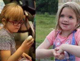 ¿Qué es el síndrome de Kleefstra? Conoce sus principales síntomas