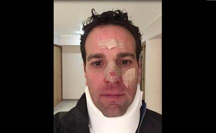 Sufre Carlos Loret lesión en juego de beisbol