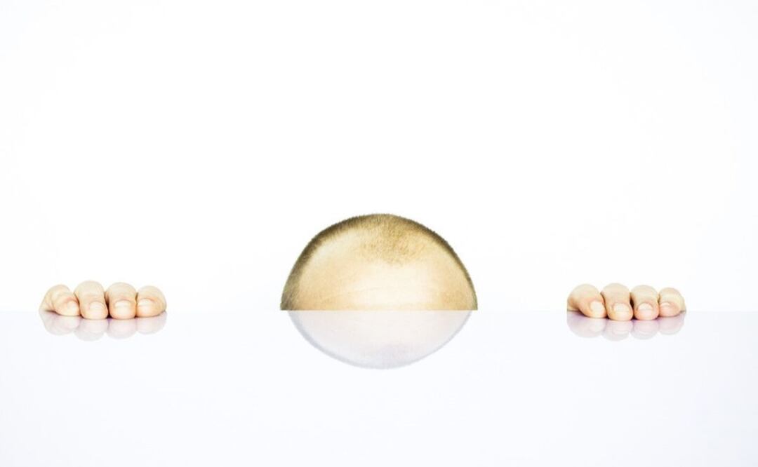 Calvicie | Fuente: Pixabay