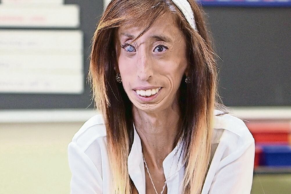 En su niñez sufría bulliyng , ahora cuenta con casi un millón de seguidores en redes (CORTESÍA)