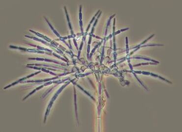 Hongos microscópicos podrían mejorar el medio ambiente