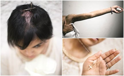 Zunduri: "Tengo razones para vivir y esperanza en las personas"