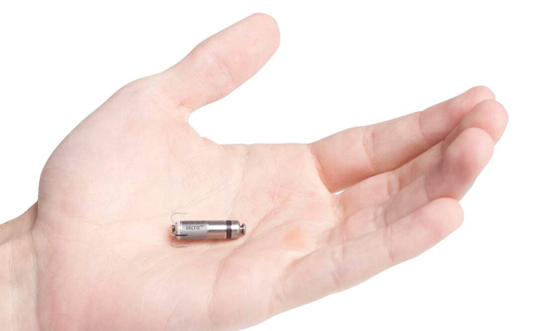 Imagen del Micra TPS de la compañía Medtronic. Foto: EFE