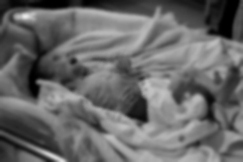 Impactante foto de bebé desnutrida revela el horror de la crisis alimentaria en Siria