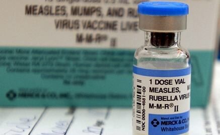 Discrepan UNAM y Ssa por casos de paperas