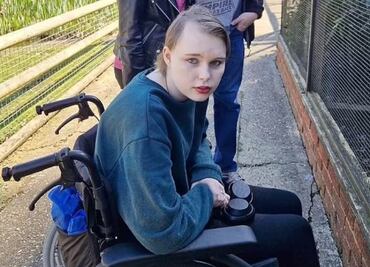 ¡No era estrés! Mujer tenía fuertes dolores, pero por negligencia médica ahora es demasiado tarde