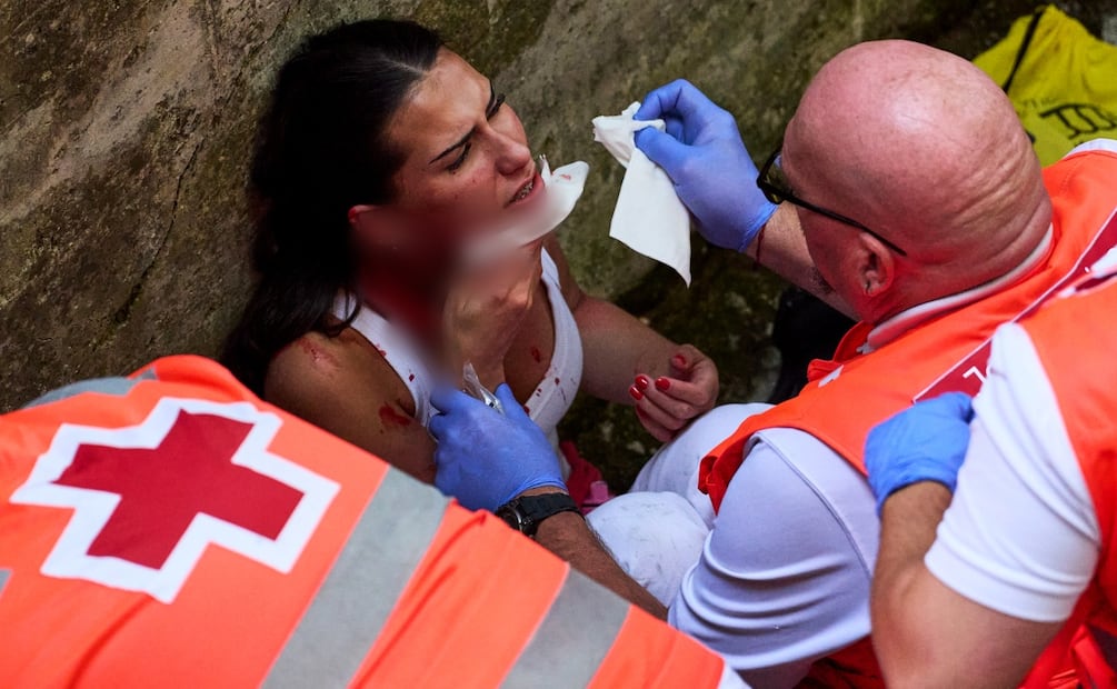 Personal de emergencia brinda los primeros auxilios a mujer que resultó corneada en el rostro durante el encierro de este sábado en San Fermín (11/07/2026). Foto: AP