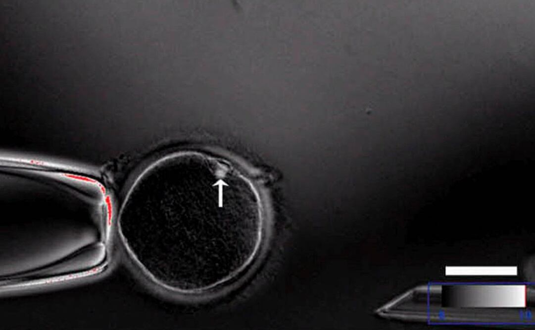 Imagen sobre la implantación de un embrión humano dentro del cuerpo de una persona. Foto: Archivo