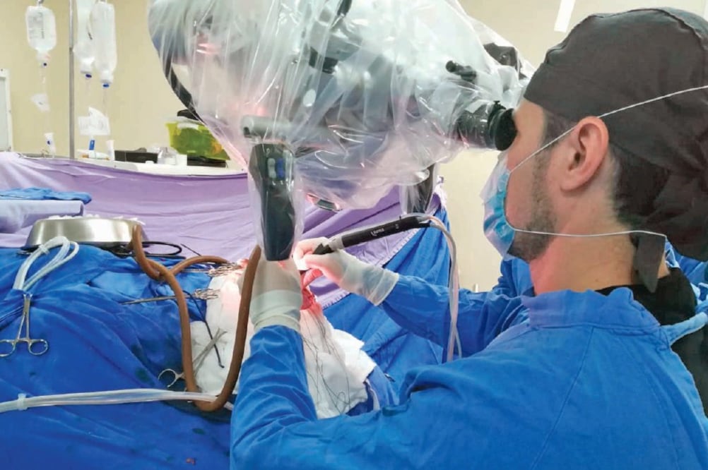 Operación exitosa. Valentina estuvo en quirófano más de tres horas y fue intervenida por un equipo multidisciplinario de neurocirujanos. (ARCHIVO EL UNIVERSAL)