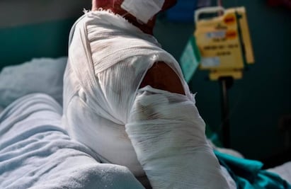 Sujeto quema con solventes a mujer en situación de calle en Guadalajara