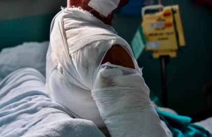 Sujeto quema con solventes a mujer en situación de calle en Guadalajara