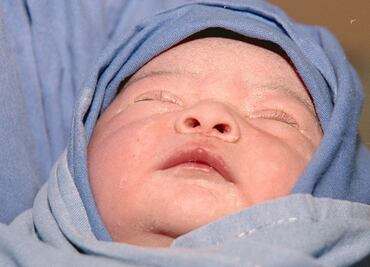 Niños por reproducción asistida son más enfermizos