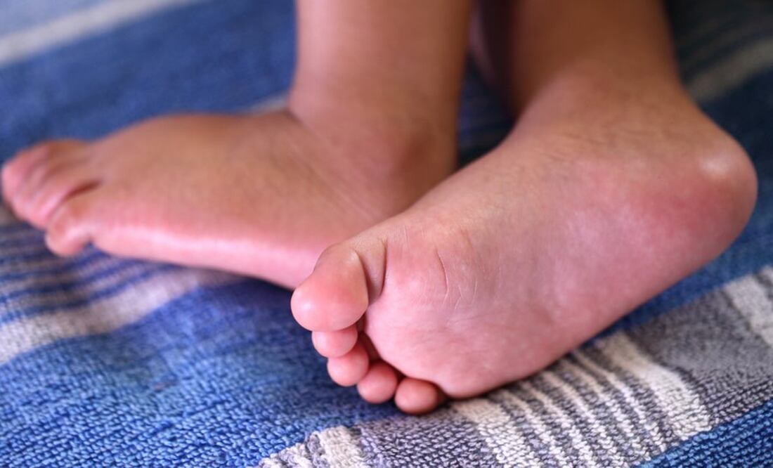 Arifa Sultana no tenía ni idea de que estaba embarazada de gemelos (Foto: iStock)