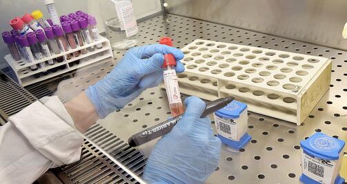 The Jack Ma Foundation and the Alibaba Foundation donate 50,000 COVID-19 test kits to Mexico