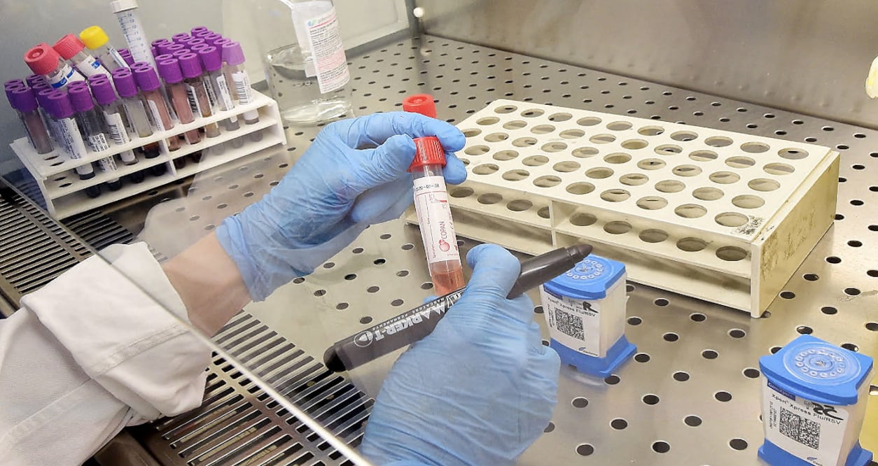 The donations arrived in Mexico on March 31 - Photo: Alessandro Di Marco/EFE