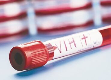 Van 3 mil 500 casos nuevos de VIH y sida en la CDMX