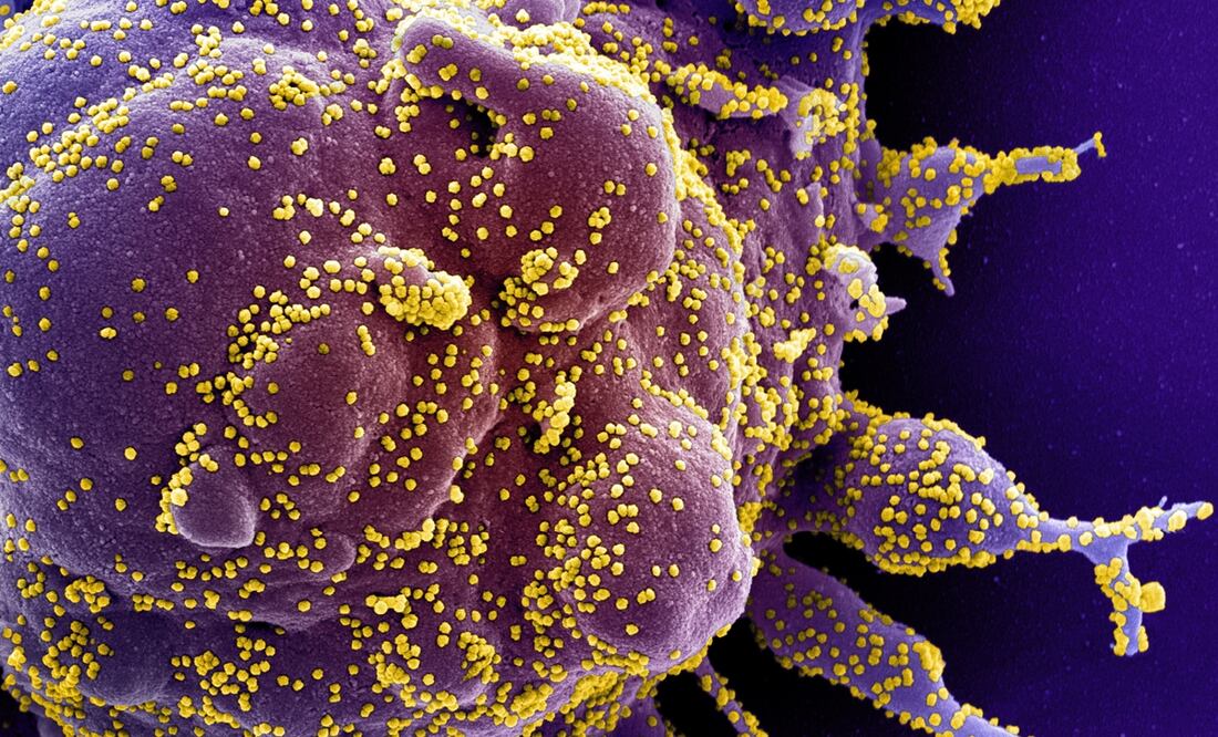 Foto: EFE/EPA/NIAID/NATIONAL INSTITUTES OF HEALTH