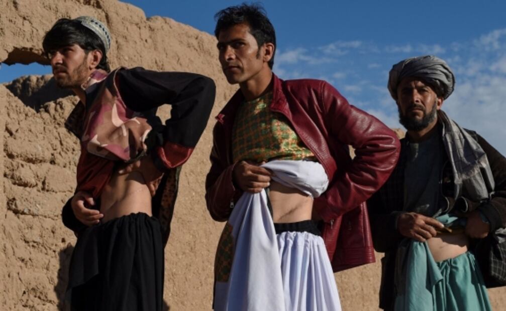 “Vendí mi riñón para que mis hijos coman”: el drama de decenas de afganos