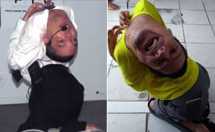 Claudio Vieira, el predicador brasileño que nació con la cabeza al revés