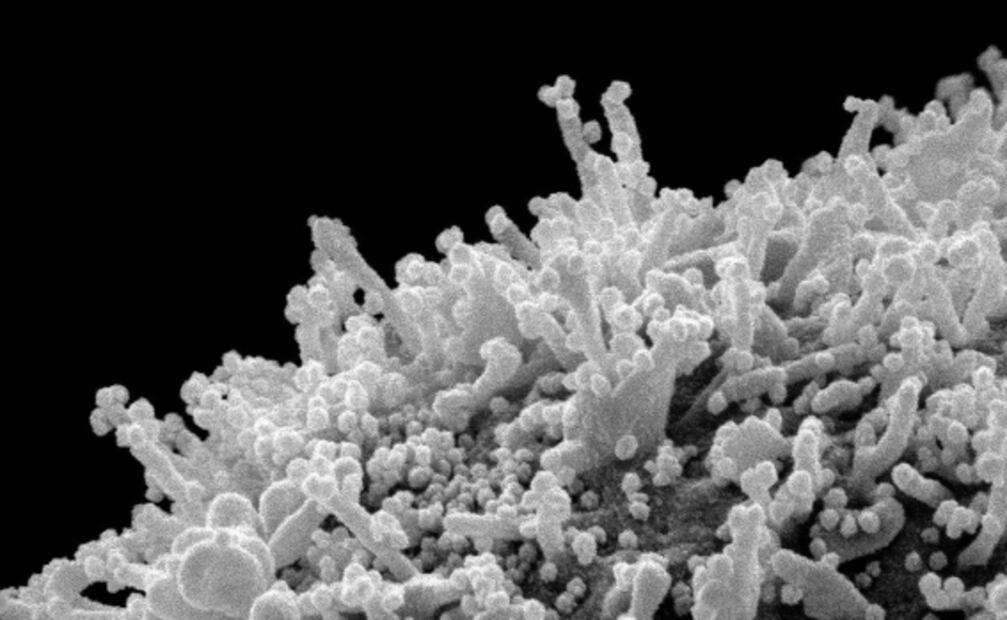 N501Y: Lo que sabemos de la variante del Covid-19 hallada en Sudáfrica