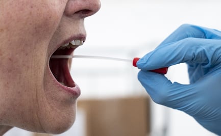 ¿Funcionan las pruebas rápidas del coronavirus? Esto han revelado diversos estudios