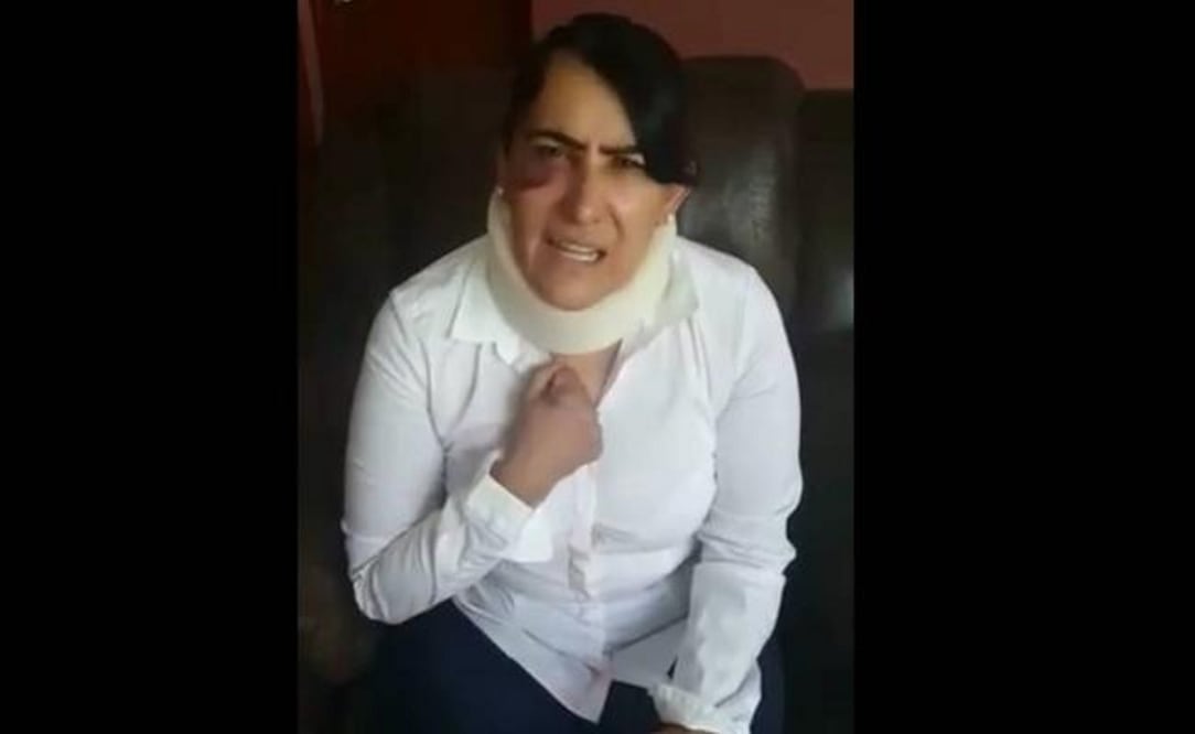 Rosa Margarita Ortiz Macías, víctima deabuso sexual y golpes durante un asalto a un autobús foráneo (ESPECIAL)