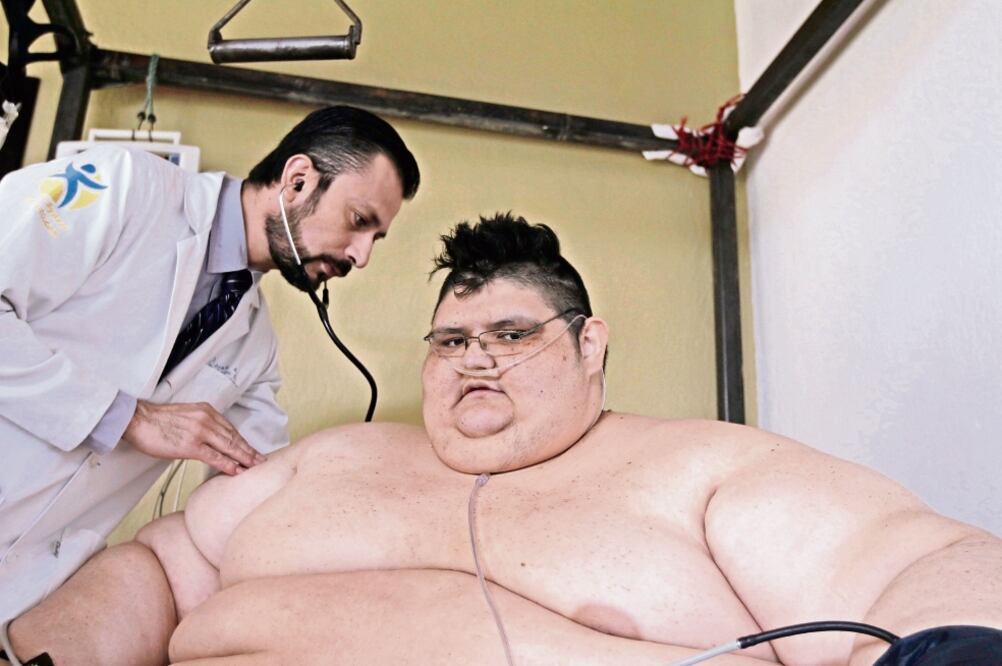 Juan Pedro es originario de Aguascalientes. Su equipo médico, a cargo de José Antonio Castañeda, se ha hecho cargo de la mayoría de los gastos para el tratamiento; su objetivo es que en año y medio el joven pese 90 kilos (CORTESÍA)