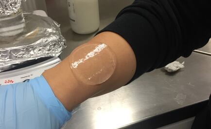 Estudiantes mexicanos desarrollan parche a base de sábila para sanar heridas leves