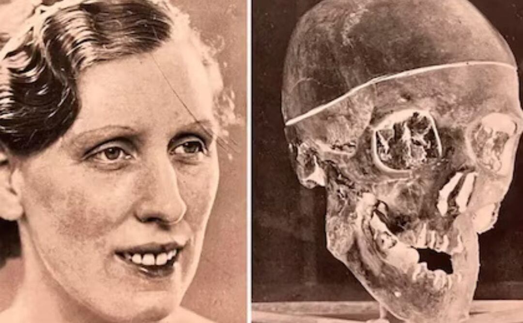 El caso Ruxton, un crimen que transformó la ciencia forense. Fuente: Freepik.