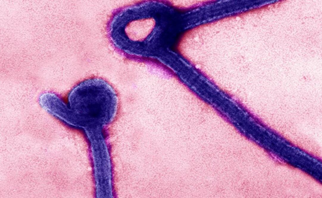 El virus infectó a más de 28 mil personas y causó la muerte a más de 11 mil 300 personas en África Occidental. Foto: Archivo