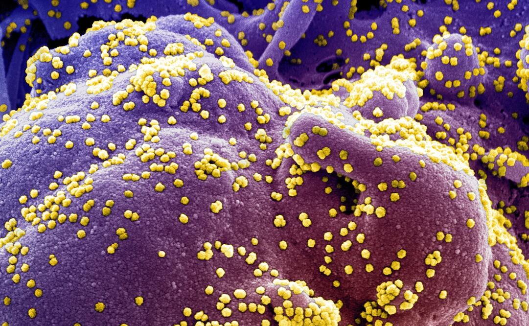 Foto: EFE/EPA/NIAID/NATIONAL INSTITUTES OF HEALTH HANDOUT