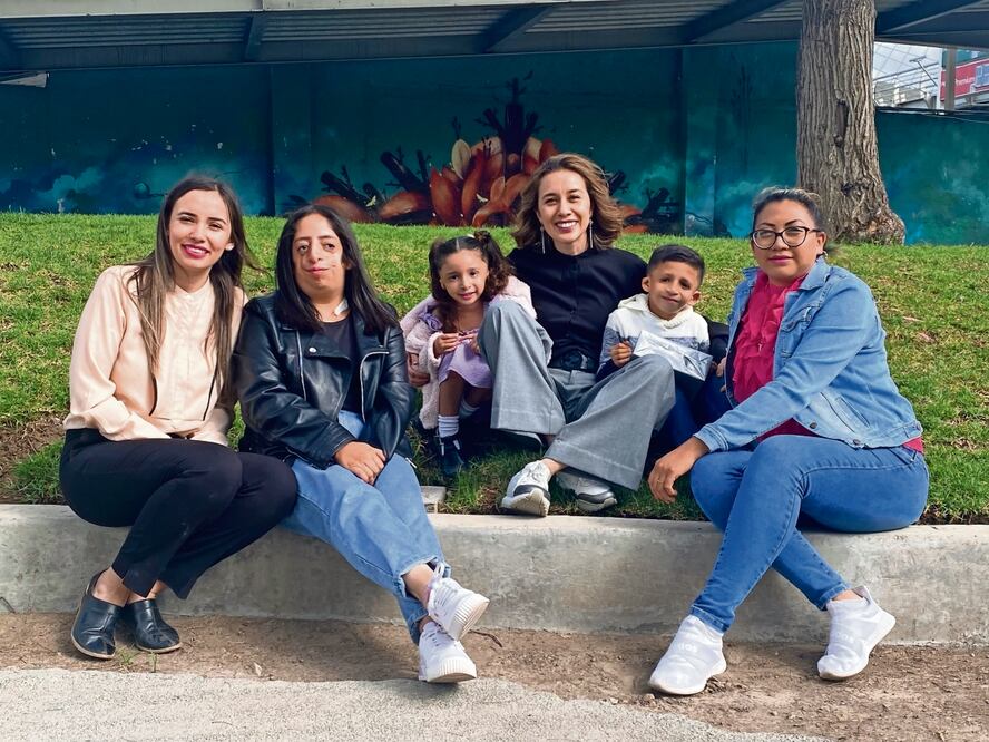 El primer caso en México de síndrome de Treacher Collins se registró en 2015, con la llegada de Liam. Esta enfermedad se caracteriza por deformidad en pómulos, mandíbula y orejas. Foto: Dinorath Mota