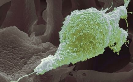 ¿Cómo se transforma una célula normal en una célula cancerosa?