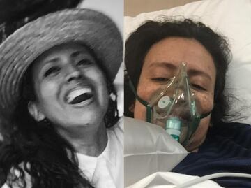 "Ya no soy yo": la pesadilla de la colombiana que lleva más de tres años con Covid