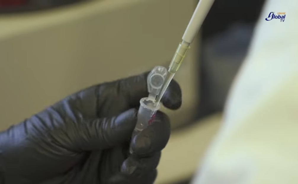 Luego de cada mujer toma la muestra, personal especializado la analiza, para tener el resultado en 30 minutos. Foto: Revista UNAM Global