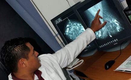 Estos son los tipos de cáncer que más afectan a los mexicanos
