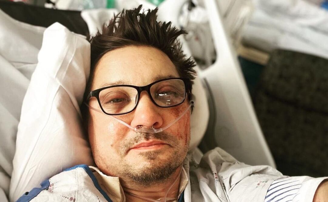 La primera foto que el actor compartió en sus redes tras el accidente.