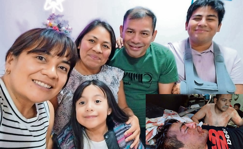 Flor (segunda de izquierda a derecha), Juan Manuel y Alexis aseguraron que el accidente les dejó una nueva oportunidad de vivir y de ayudar. Quieren volver a Oaxaca a agradecer a quienes los apoyaron.

Alexis tuvo una abertura en la cabeza y fractura del brazo derecho. Fotos: Especiales