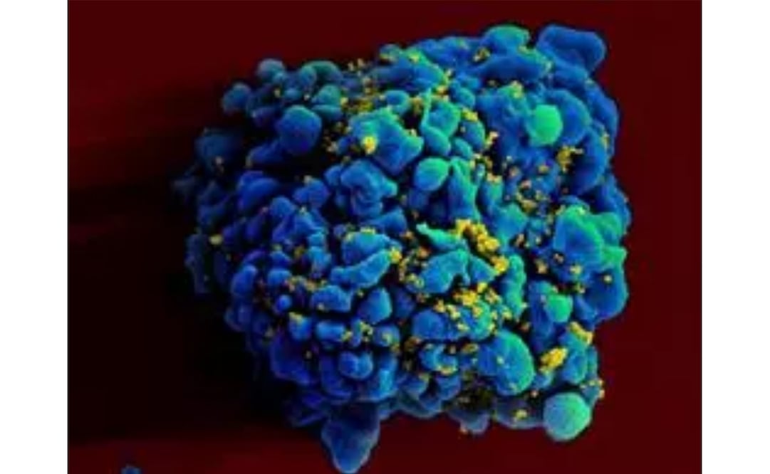 Escaneo electromicrográfico de una célula T infectada con VIH. Foto: NIAID vía Europa Press, archivo