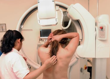 Identifican origen celular de cáncer de mama