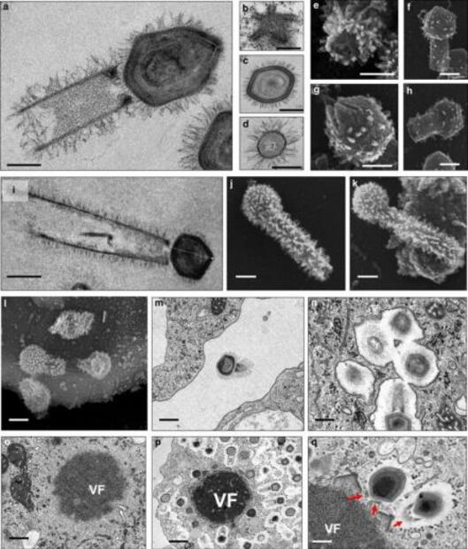 Descubren dos nuevos virus gigantes capaces de ensamblar proteínas