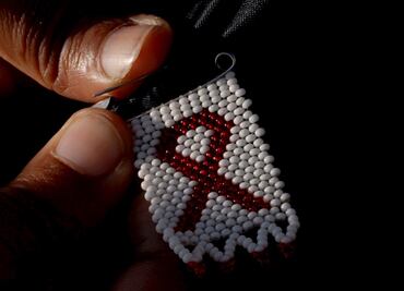 Trasplantes en pacientes con VIH, podrían terminar con tratamientos antirretrovirales