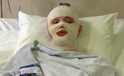 Nací bajo estrella de la suerte: sobreviviente de atentados