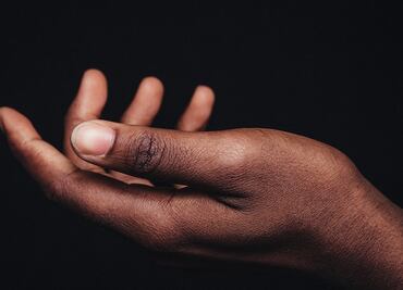 3 remedios naturales que curan los hongos de las manos